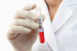 Blood Test Vial
